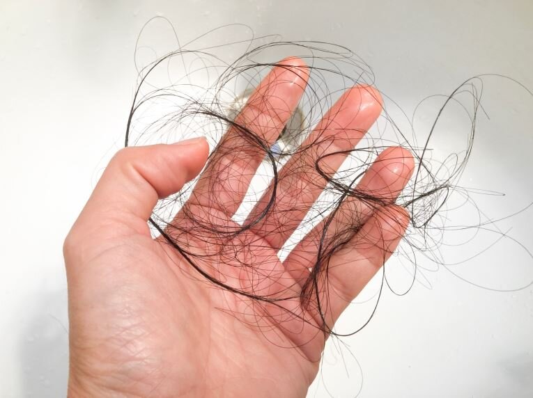 روش های پیشگیری و جلوگیری از ریزش مو، ابرو و مژه